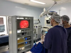Acesso ao tumor localizado no cérebro é feito pelo nariz utilizando um sistema de vídeo em técnica minimamente invasiva