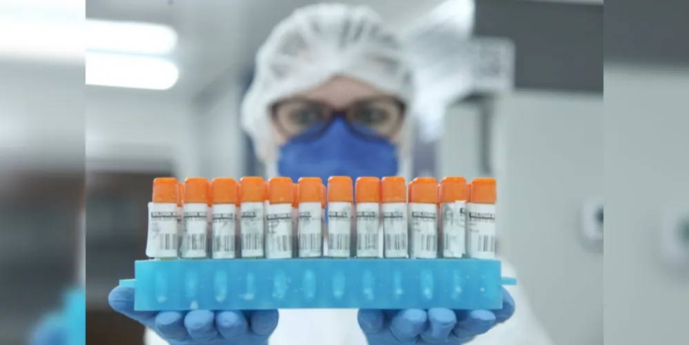 Para realizar o inquérito molecular das variantes, a equipe emprega a estratégia chamada ‘PCR em tempo real’