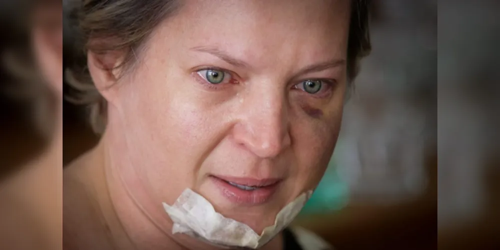 Deputado federal Joice Hasselmann (PSL) com ferimentos no rosto.