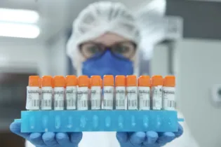 Para realizar o inquérito molecular das variantes, a equipe emprega a estratégia chamada ‘PCR em tempo real’