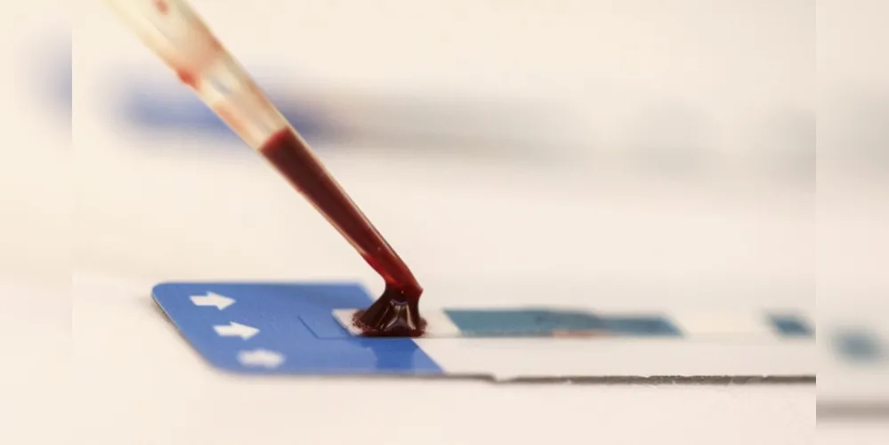 Em laboratório, técnica desenvolvida pelo Instituto de Física de São Carlos conseguiu combater o vírus HIV
