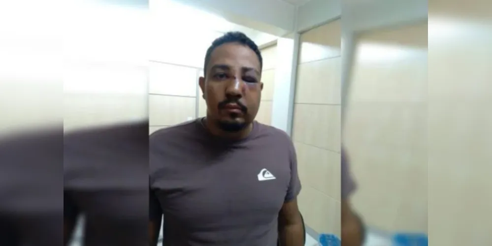 A vítima ficou com várias marcas da agressão no rosto e perdeu alguns dentes.