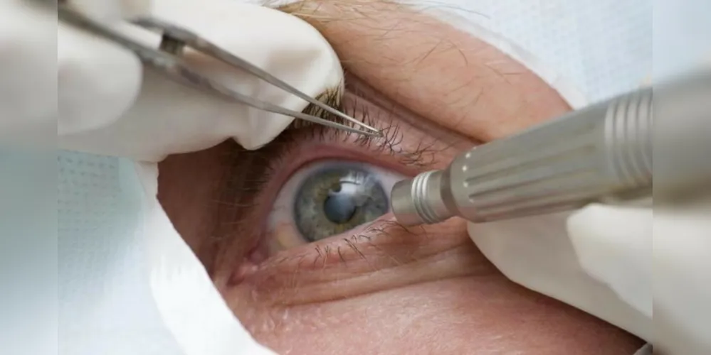 Abril Marrom educa as pessoas sobre doenças que podem acometer os olhos e ser detectadas preventivamente.