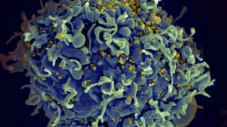 Eletromicrografia mostra HIV infectando célula humana