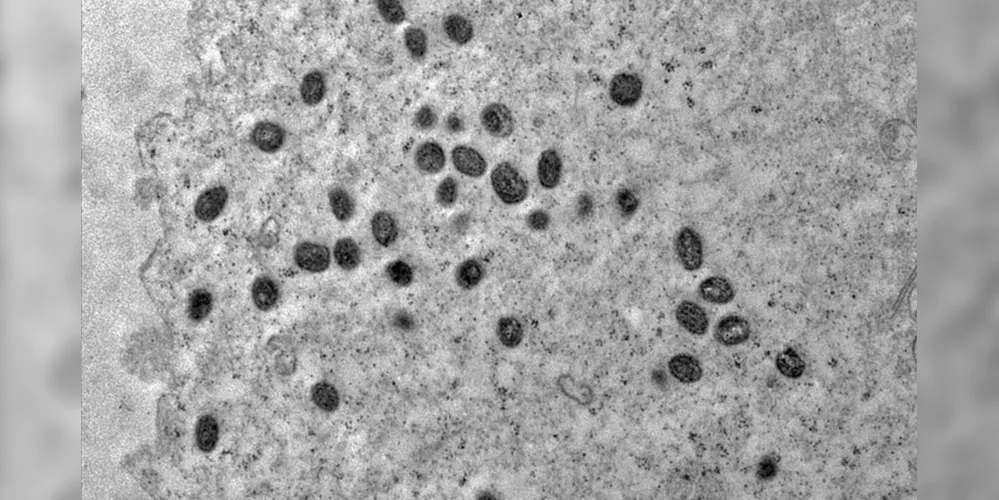 Até o momento, há 8.340 casos confirmados de varíola dos macacos no Brasil