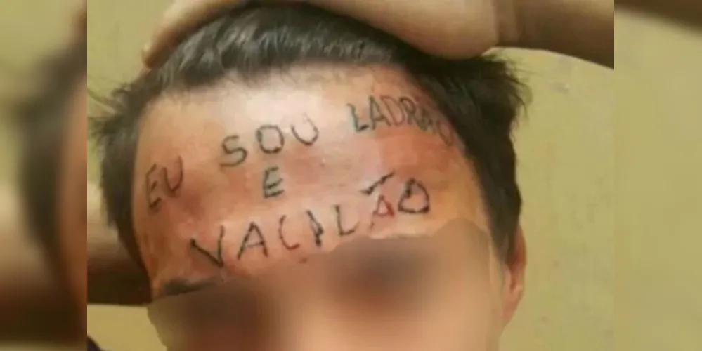 Jovem teve a testa tatuada por dois homens, em 2017