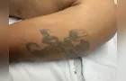 HU-UEPG tenta identificar paciente através das tatuagens