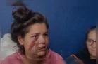 'Tiraram um pedaço de mim', diz mãe de menino atropelado no Paraná