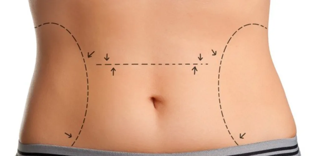 Imagem ilustrativa da imagem Cirurgia plástica: o que levar em conta antes de tomar uma decisão?