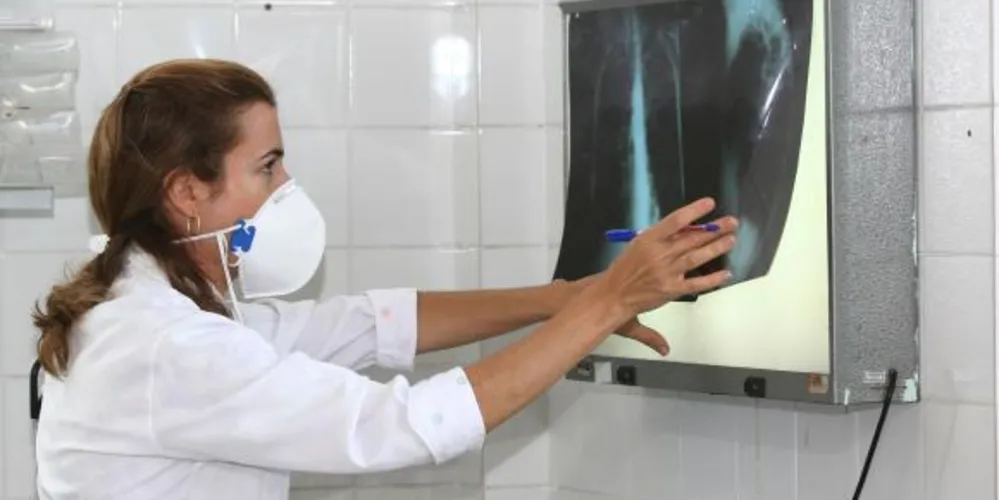 Imagem ilustrativa da imagem Parar tratamento da tuberculose pode fortalecer doença