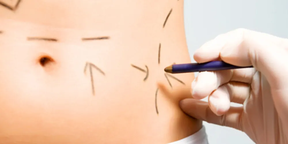 Imagem ilustrativa da imagem Especialista responde dúvidas comuns sobre cirurgia plástica estética