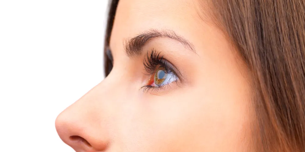 Imagem ilustrativa da imagem A febre da rinoplastia