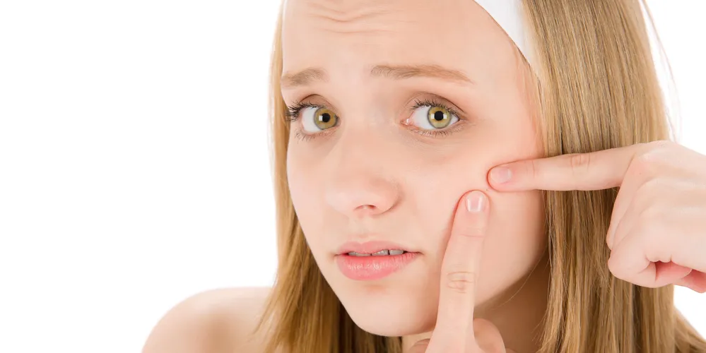 Imagem ilustrativa da imagem Conheça os três tipos de acne e os diferentes tratamentos