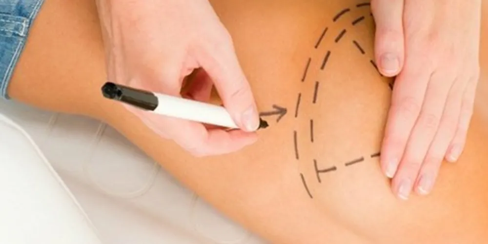 Imagem ilustrativa da imagem Cirurgia reparadora pode reparar funções e melhorar a autoestima