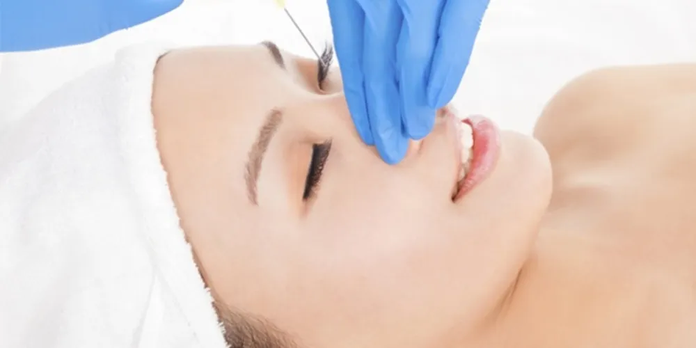 Imagem ilustrativa da imagem Rinoplastia: cirurgia de nariz é uma das mais procuradas no país