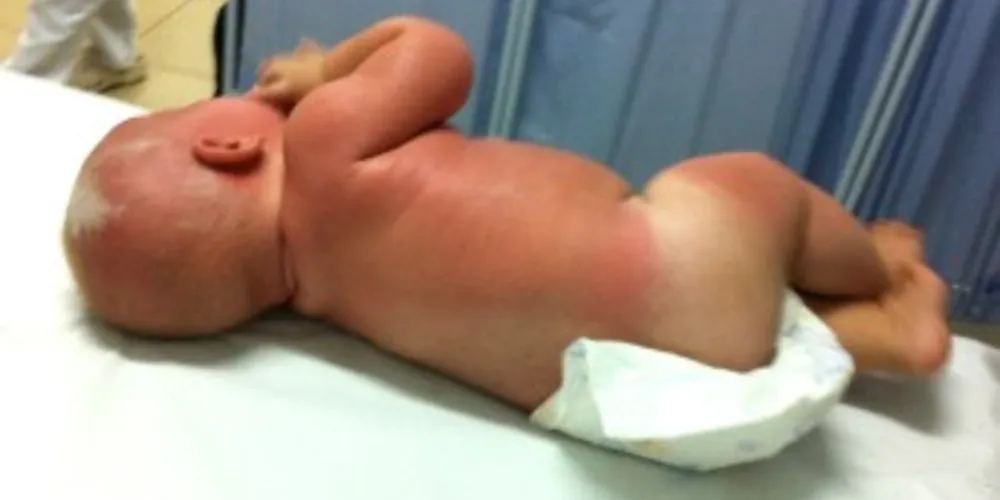 Imagem ilustrativa da imagem Pais 'esquecem' bebê de cinco meses no sol e são detidos