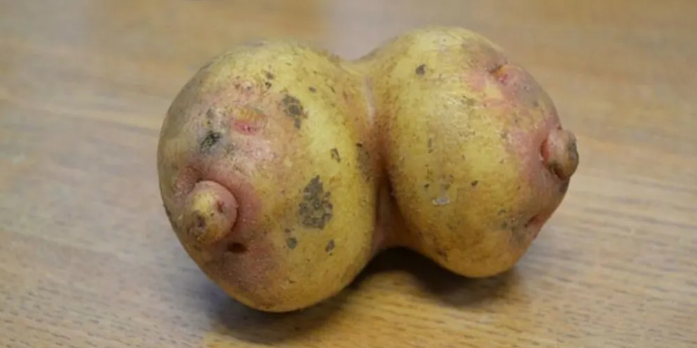Imagem ilustrativa da imagem Batatas em forma de par de seios se tornam sensação na web