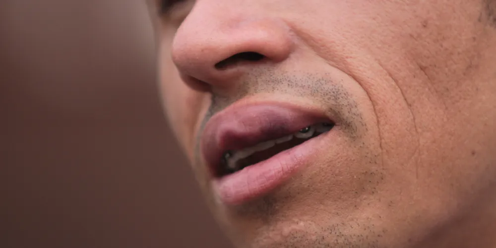 Imagem ilustrativa da imagem Aguinel é agredido em assembleia de sindicato