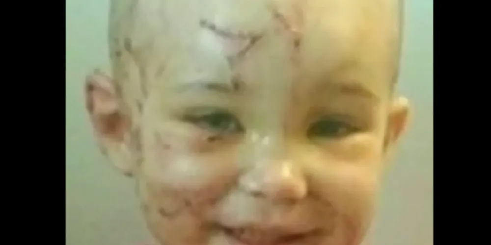 Imagem ilustrativa da imagem Mulher morde cachorro para salvar filha de ataque