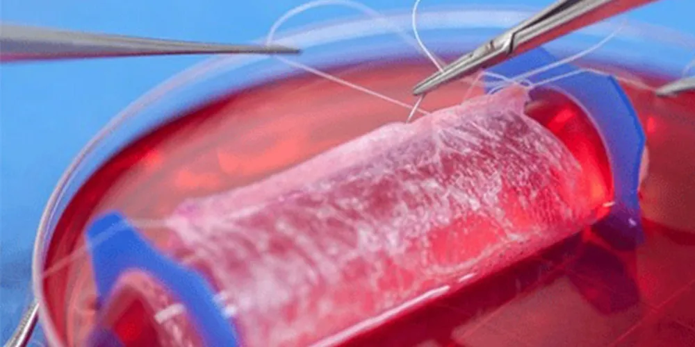 Imagem ilustrativa da imagem Médicos anunciam criação de vagina artificial para implantes