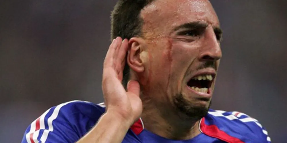 Imagem ilustrativa da imagem Terceiro melhor do mundo, Ribéry é cortado da Copa