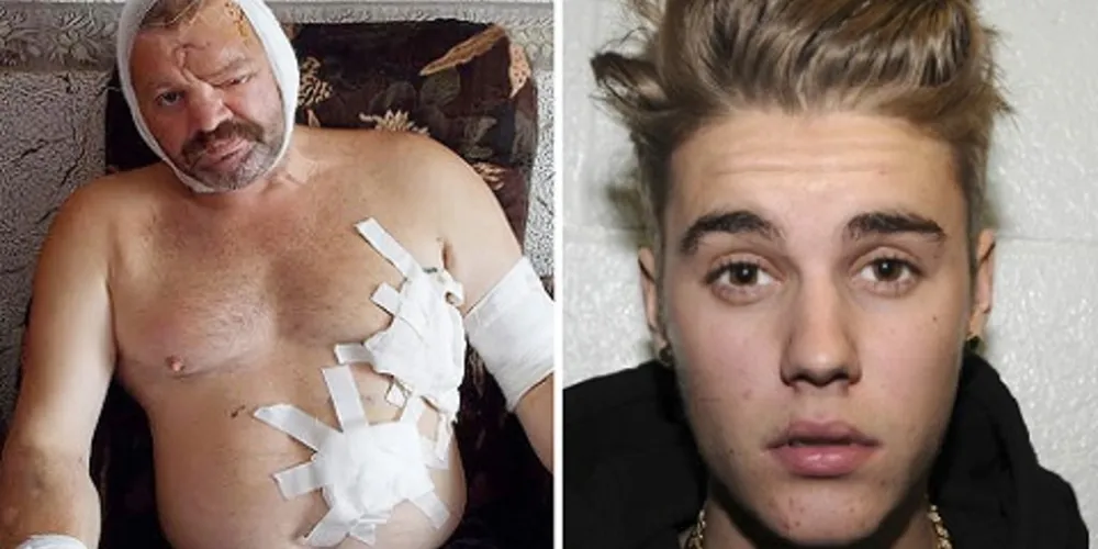 Imagem ilustrativa da imagem Justin Bieber 'salva' homem de ataque de urso na Rússia