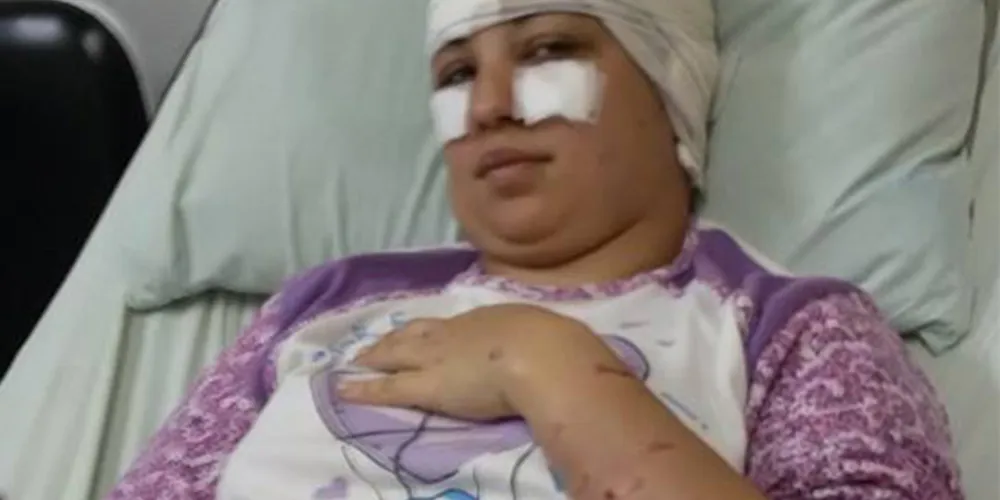 Imagem ilustrativa da imagem Mulher sofre lesões graves em ataque de cachorros