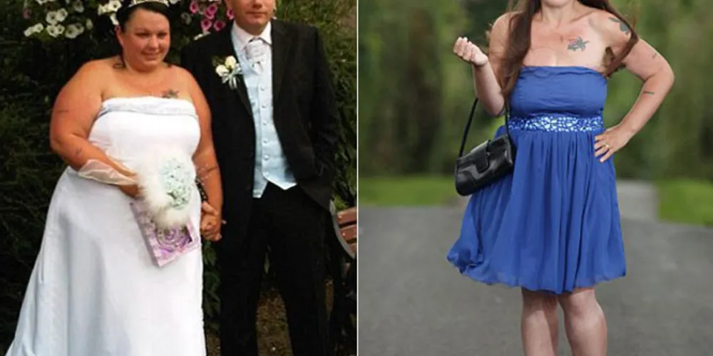 Imagem ilustrativa da imagem Mulher perde 70 kg após ser vaiada no próprio casamento
