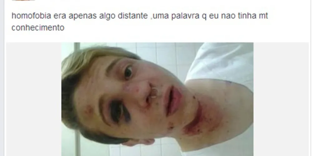 Imagem ilustrativa da imagem Jovem agredido diz ter sido vítima de homofobia