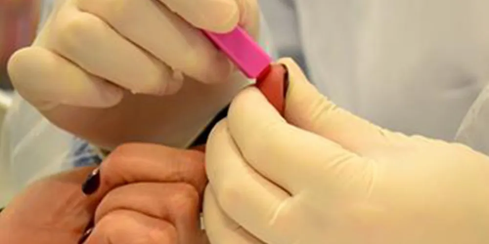 Imagem ilustrativa da imagem Pacientes de hepatite C poderão contar com novo tratamento