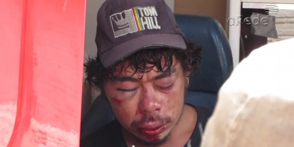 Imagem ilustrativa da imagem Homem é socorrido gravemente ferido após agressão