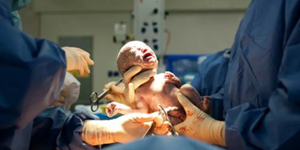 Imagem ilustrativa da imagem Governo pode permitir cesariana sem presença de pediatra