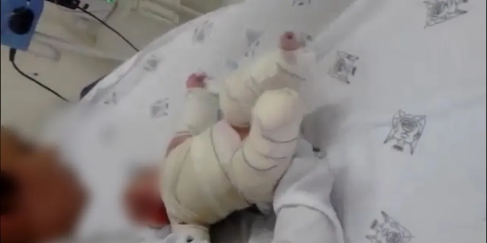 Imagem ilustrativa da imagem Com infecção grave, bebê de 3 meses aguarda vaga na UTI