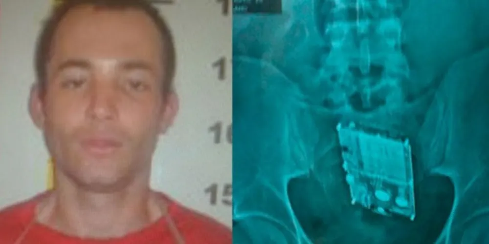 Imagem ilustrativa da imagem Detento vai para hospital com celular no intestino em Minas