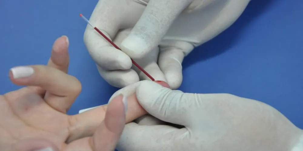 Imagem ilustrativa da imagem Epidemiologia registra 112 novos casos de Aids em PG 