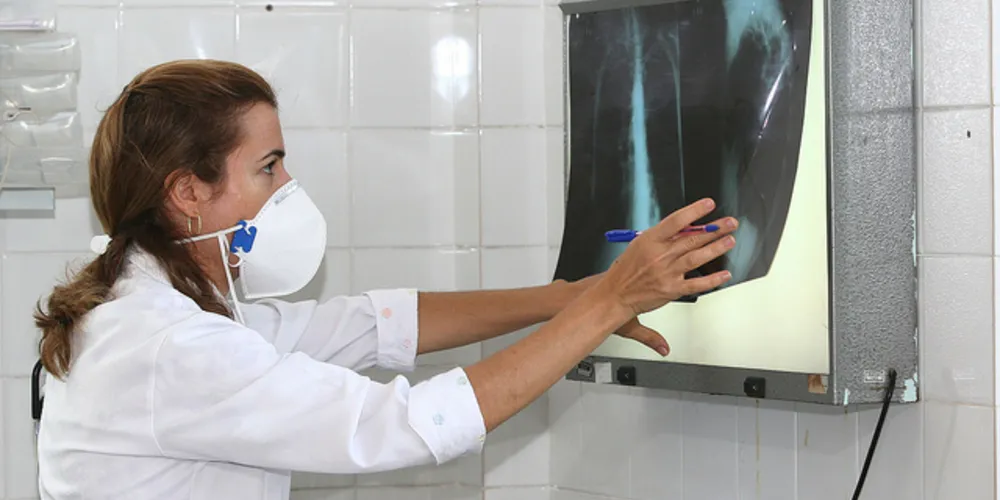 Imagem ilustrativa da imagem Mortes por tuberculose caem 42% desde 1990, mostra OMS