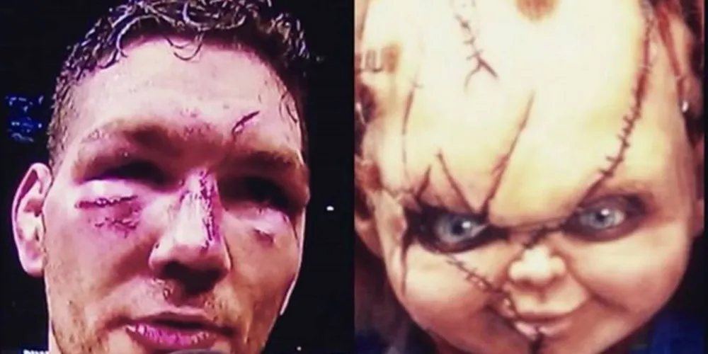 Imagem ilustrativa da imagem Rosto Weidman é comparado aos de Chucky e Frankenstein