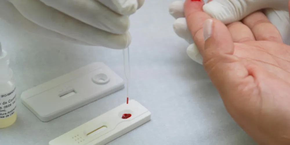 Imagem ilustrativa da imagem Palmeira tem aumento de 30% nos casos de HIV