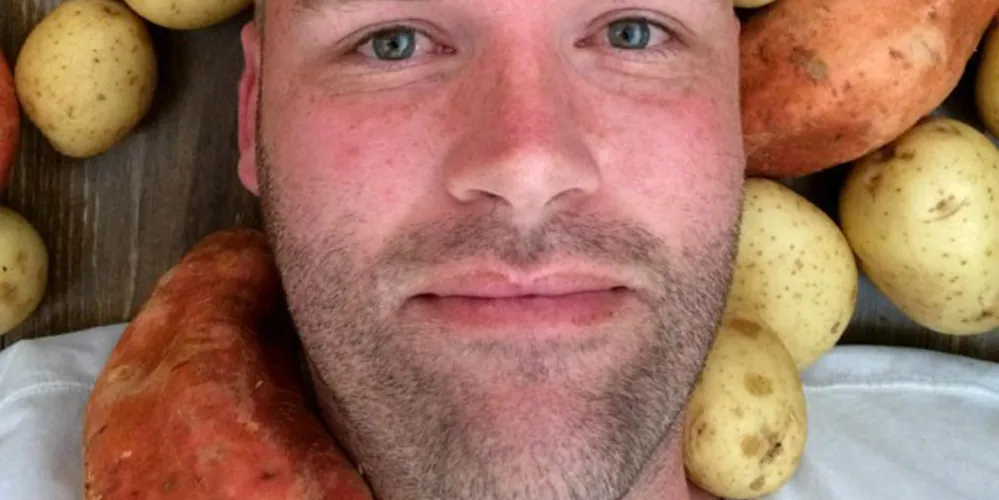 Imagem ilustrativa da imagem Com dieta bizarra, homem promete comer só batatas por 1 ano