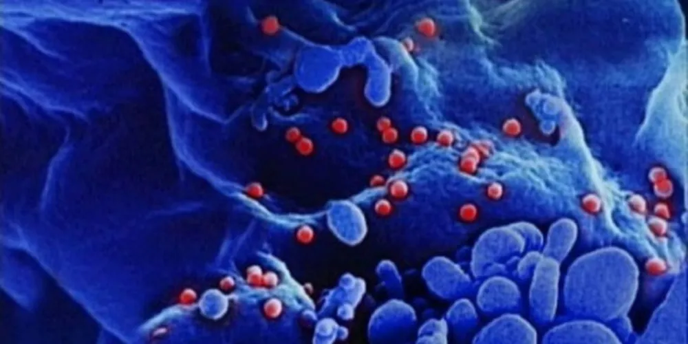 Imagem ilustrativa da imagem Pesquisadores anunciam cura do HIV 'em alguns meses'