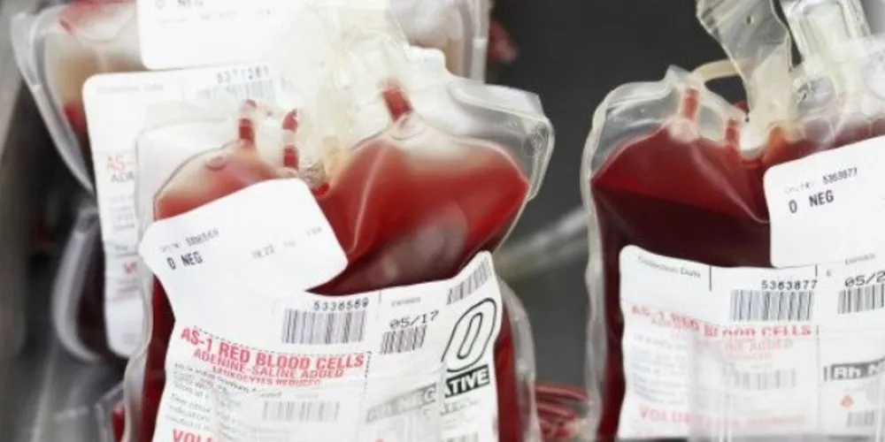 Imagem ilustrativa da imagem Tecnologia inativa vírus em bolsas de sangue